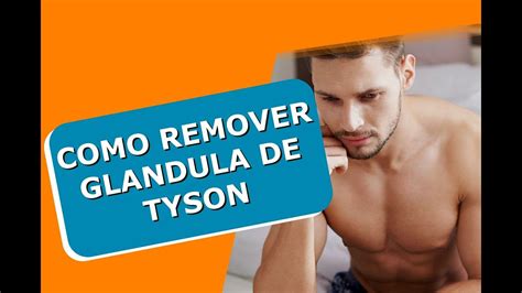 glandula de tyson|Glândulas de Tyson: o que são e veja se é preciso tratá